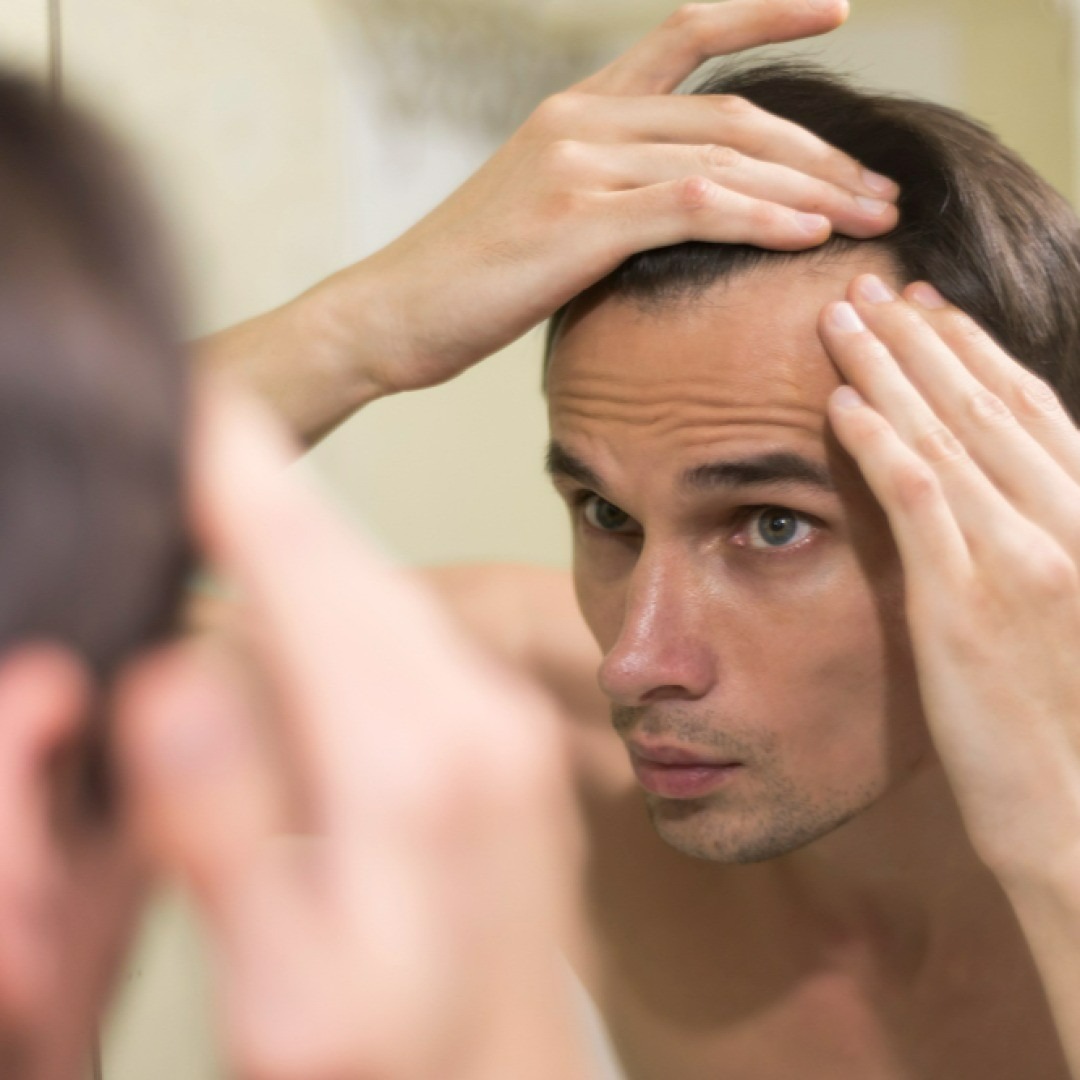 How Lifestyle Factors Affect Hair Transplant Success