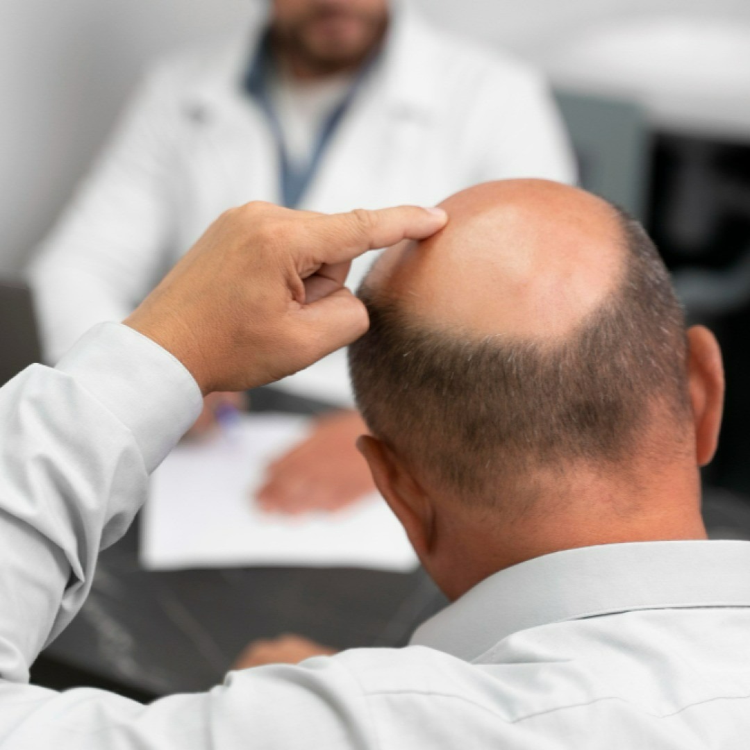 Preparing for Your Hair Transplant: What to Expect