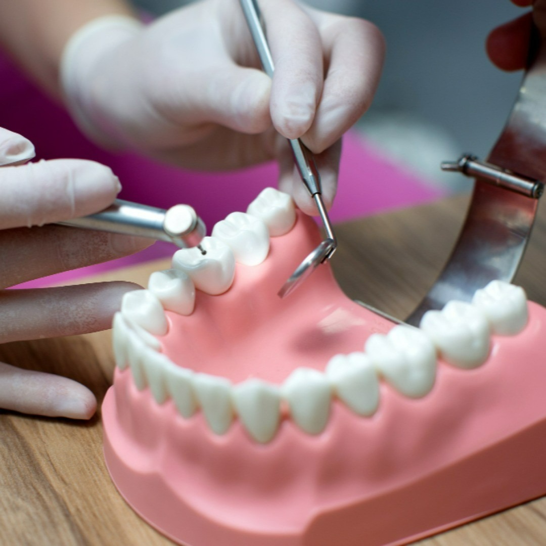 Dental Implants vs. Bridges: Which is Right for You?